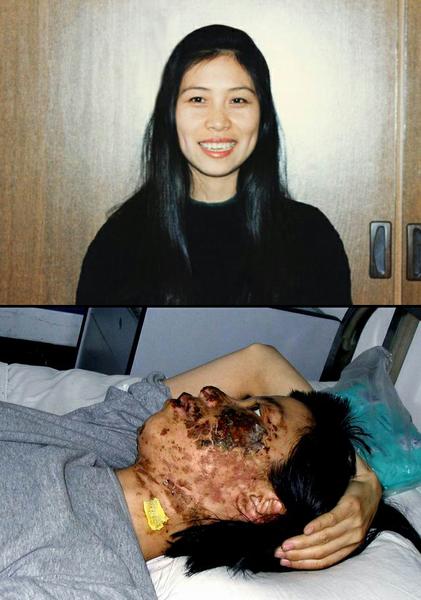 Практикующая цигун Фалуньгун 36-летняя Гао Жунжун. До и после ареста и пытки электрическими дубинками в область лица